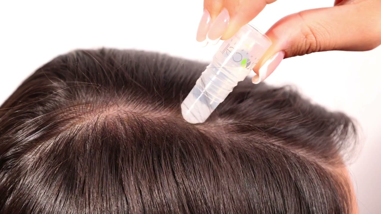 Microchanneling precision pen treatment at Miami Blue Spa